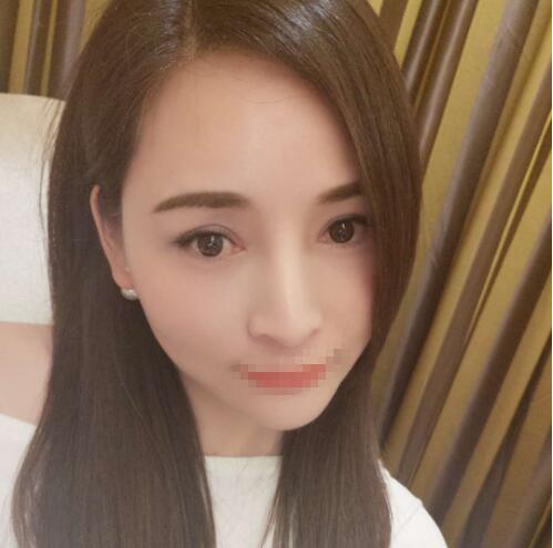 北京百達麗王維眼修復(fù)案例