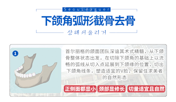 崔榮達(dá)醫(yī)生科普下頜角整形手術(shù)