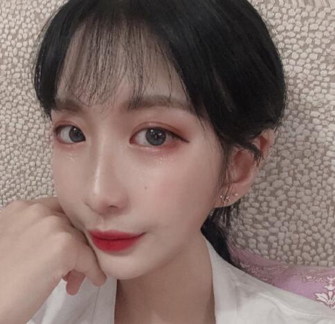 上海九院柴崗磨骨手術(shù)案例分享