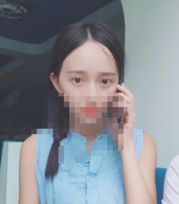 北京八大處趙延勇醫(yī)生做雙眼皮怎么樣？