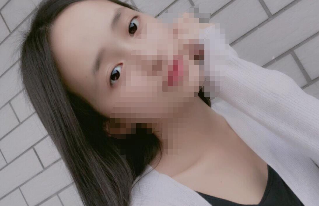 北京八大處趙延勇醫(yī)生做雙眼皮怎么樣？