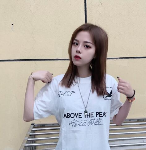 北京劉風(fēng)卓做雙眼皮修復(fù)案例