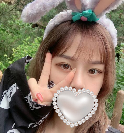 北京劉風(fēng)卓做雙眼皮修復(fù)案例