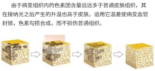 北京臻瑞尚美宋瑜醫(yī)生科普激光美容