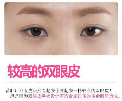 王振軍醫(yī)生科普眼修復(fù)手術(shù)