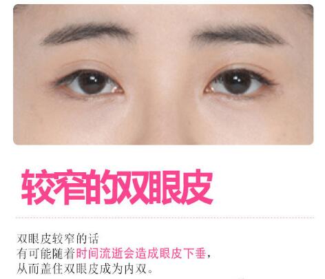 王振軍醫(yī)生科普眼修復(fù)手術(shù)