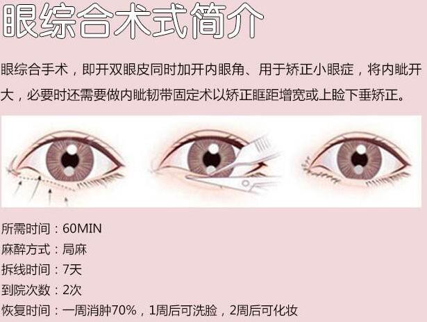 鄭美善醫(yī)生科普雙眼皮相關(guān)知識(shí)