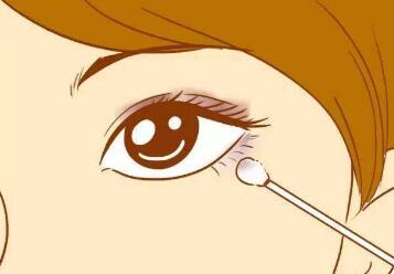 鄭美善醫(yī)生科普雙眼皮相關(guān)知識(shí)