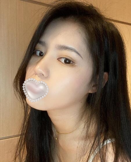 莊洪興醫(yī)生隆鼻果圖