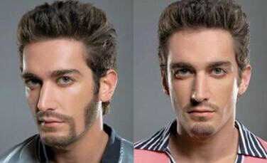 去除絡(luò)腮胡