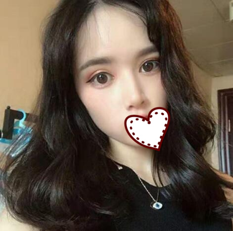 何禎平醫(yī)生隆鼻案例