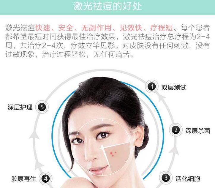 醫(yī)美方式祛除痘疤