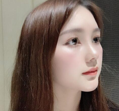 威塑吸脂面部果圖