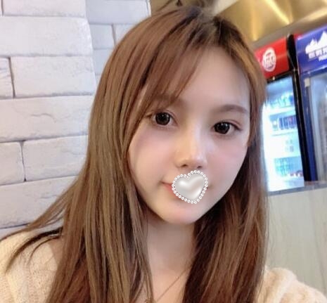 威塑吸脂面部果圖