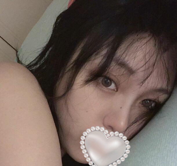 透明質(zhì)酸注射除皺果圖分享