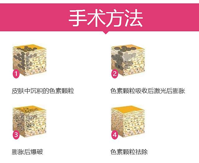 怎樣使乳暈變紅