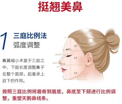 鼻翼肥大縮鼻頭鼻翼的方法