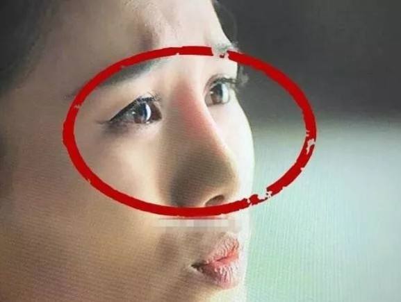 硅膠隆鼻的副作用