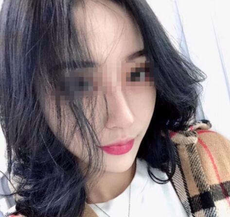 削骨瘦臉果圖分享