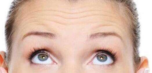 抬頭紋產(chǎn)生的3個緣故