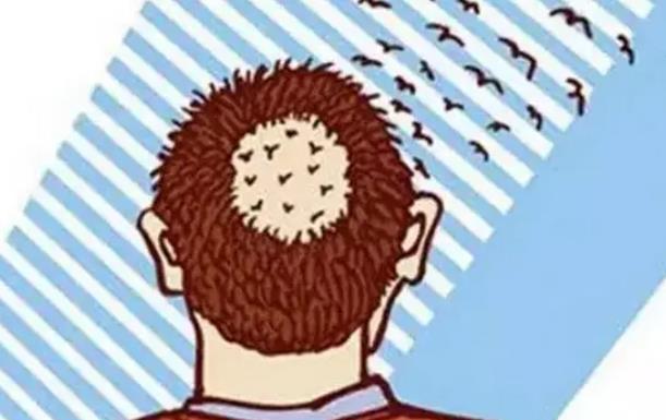 tddp植發(fā)技術(shù)