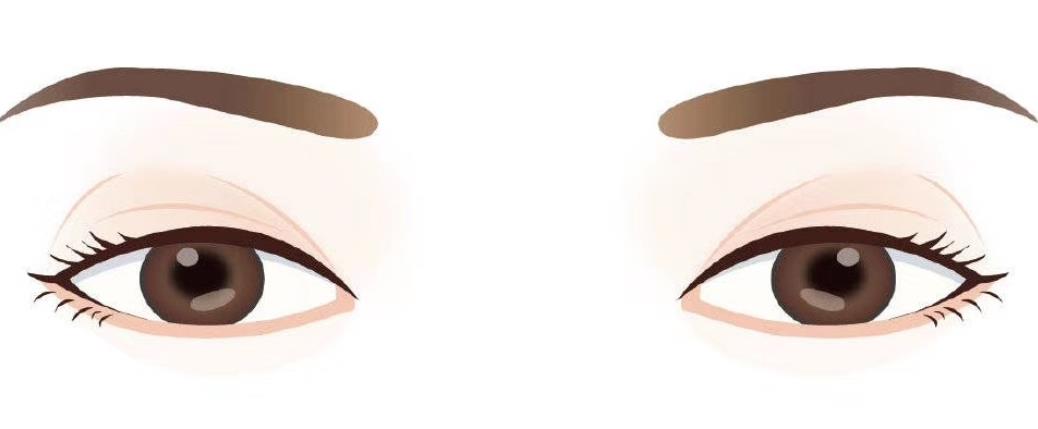 雙眼皮