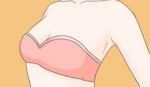 內(nèi)窺鏡隆胸恢復(fù)期要多久？各階段的恢復(fù)情況和注意事項