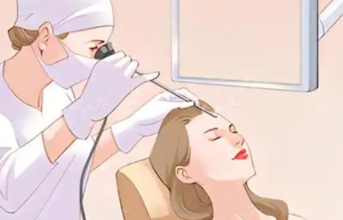 內(nèi)窺鏡提升和線雕哪個好？輕度松垮和明顯下垂，思路真的不一樣